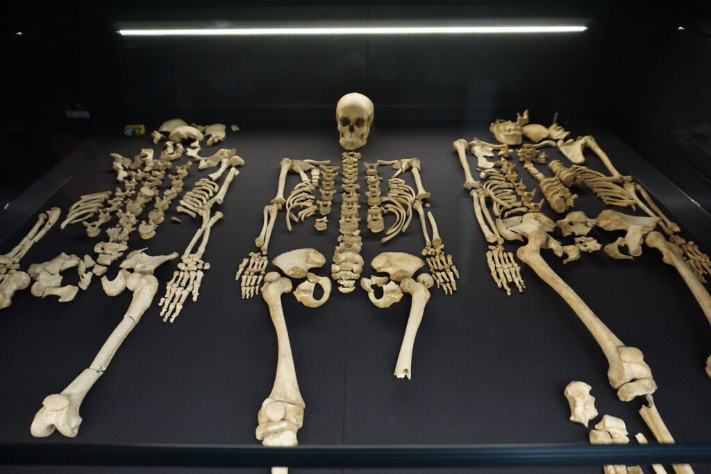 Three human skeletons are displayed on a black surface in a museum exhibit at the Kilkenny Medieval Mile Museum. The central skeleton is intact, while the others are less complete. The scene is well-lit, creating a somber and educational atmosphere.